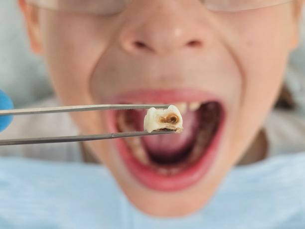 Best Emergency Pediatric Dentist  in Bloomfield Hills, MI